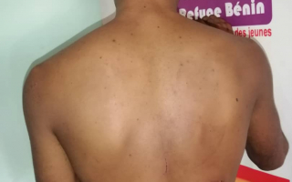 Bénin. Des policiers accusés d’avoir violemment agressé une femme transgenre.
